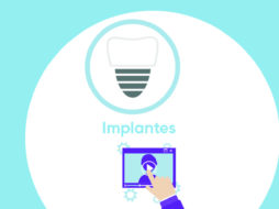 cabeceras tutorial_especialidad implantes